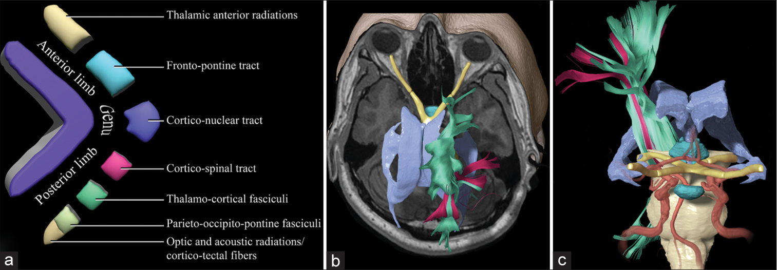 Preoperative tractography algorithm for safe resection of tumors ...